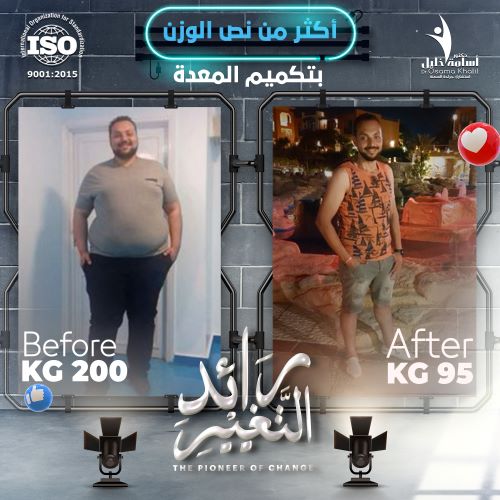 كيف أعرف أن عملية التكميم ناجحة؟